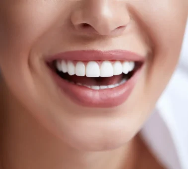 Digital Smile Design