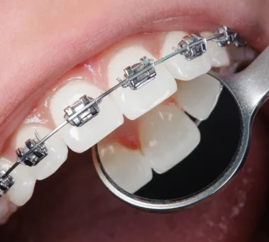 Orthodontics