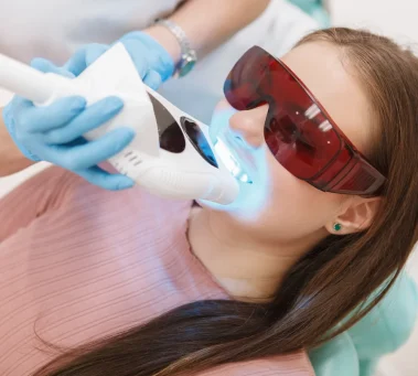 Teeth Whitening