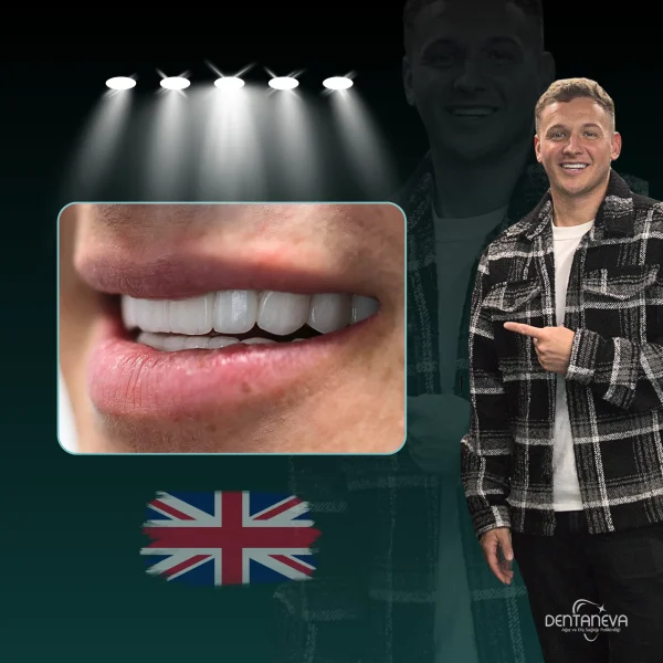 Happy UK patient showcasing his new smile after dental transformation at Dentaneva.