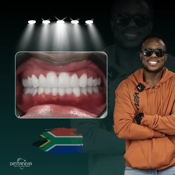 Confident smile after dental treatment at Dentaneva – South African patient.