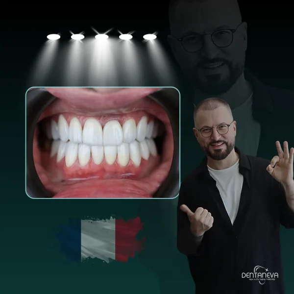 Smiling doctor showing dental veneer results with French flag in background.