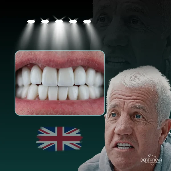 Patient result after dental treatment at Dentaneva.