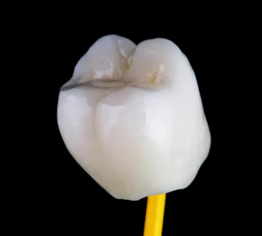 تيجان الأسنان